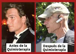 El actor Patrick Swayze tras la quimioterapia