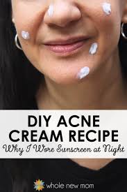 diy acne cream homemade acne treatment