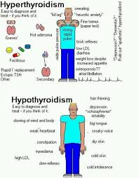 Hypothyroidism And Hyperthyroidism Health Fitness Thyroid
