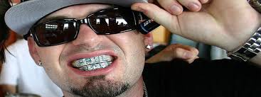 In a 2010 interview, jimmy kimmel brought up the subject. Most Notable Celebrities With Diamond Teeth Sunwest Dental Sunwest Dental