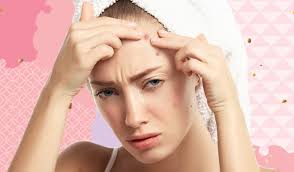 tips to get rid of pimples on forehead