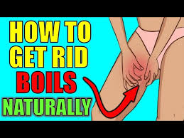 how to get rid of boils on inner thighs