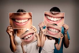 4 close the gap for any missing teeth. The Best Treatment For Gap Teeth Neem Tree Dental 2020