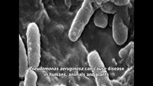 pseudomonas aeruginosa infections you
