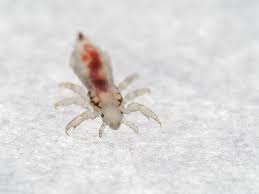 how to prevent head lice from bugging