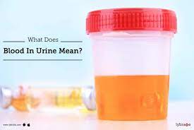 what does blood in urine mean by dr