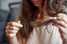pcos and hair loss tresse