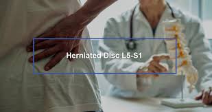 herniated disc l5 s1 dr kevin pauza