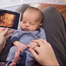 4d ultrasound houston images