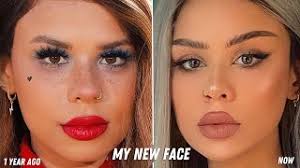 i got a new face without surgery and