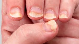 eating if you want stronger nails