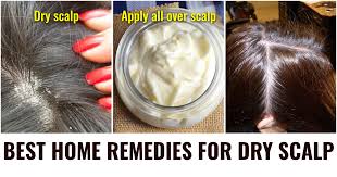 home remes to get rid of dry scalp