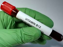Image result for b12 deficiency diagnosis