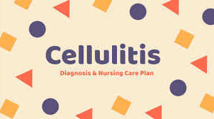 cellulitis diagnosis and nursing care