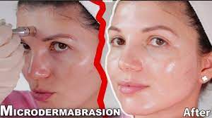 how to do microdermabrasion at home