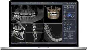 cbct dental scanning houston tx