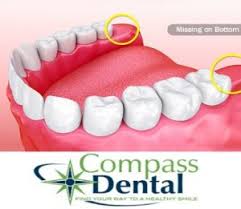 teeth removed comp dental
