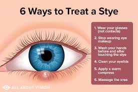 stye treatment how to get rid of a stye