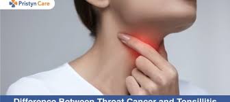 Throat cancer often affects people between the ages of 50 to 70 and predominantly affects the male gender. Difference Between Throat Cancer And Tonsillitis Pristyn Care