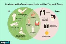rheumatoid arthritis and lupus