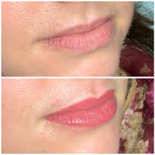 permanent lips my cosmetic solutions