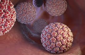 Hpv (human papillomavirus) is a virus that can cause certain cancers in males and females later in life. Hpv Can Lead To Head And Neck Cancers Lexington Medical Center Blog Lexwell