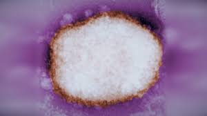 The monkeypox virus is the etiological agent of monkeypox, which can be acquired from an infected animal, such as a squirrel or monkey, through bites, direct contact with its. What Is Monkeypox The Rare Virus That Has Turned Up In The U K