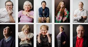 aging with down syndrome glossy
