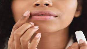 relieve dry lips during pregnancy