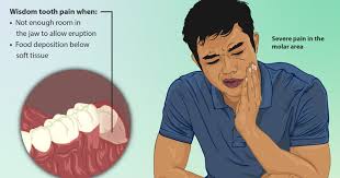 home remes for wisdom tooth pain