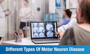 motor neurone disease mnd