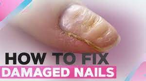 how to fix damaged nails short square