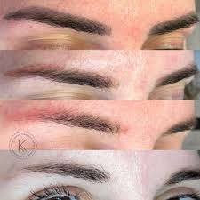 permanent makeup removal cost pmuhub