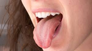 what really causes a sore tongue