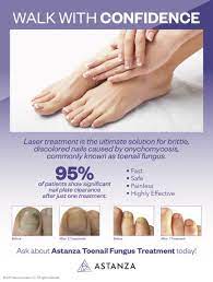 astanza toenail fungus treatment poster