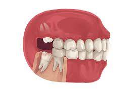 Prairie Dental Group gambar png