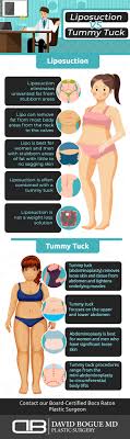 liposuction vs tummy tuck board