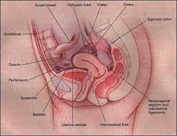 Endometriosis is a chronic pelvic disorder that many women seldom know of. Endometriosis Endotext Ncbi Bookshelf