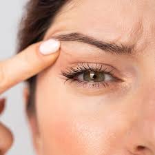 remes to tackle sagging eyelids