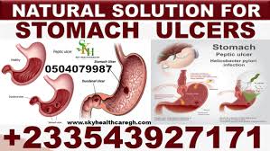 natural remes for gastric ulcer in