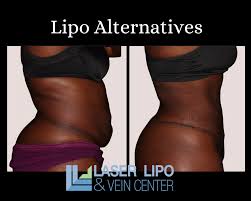 alternatives to liposuction in st