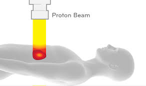 cost of proton beam therapy in india