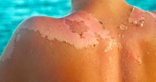 Image result for Viagra does not cause melanoma