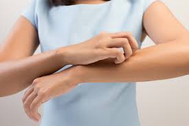 how long do eczema rashes last