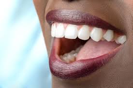 This type of denture can be secured to the patient's jawbone once it heals, which can take anywhere from four to six months. How Long Will It Take To Recover From A Full Mouth Reconstruction Lifetime Dental Tavares Florida