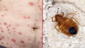 10 signs of bed bugs to never ignore