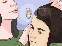 12 ways to get rid of lice wikihow