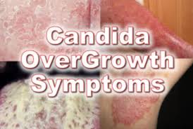 candida could you have an overgrowth