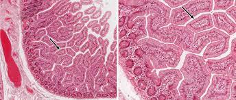 Dr matt & dr mike. Small And Large Intestine Histology