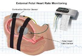 An External Fetal Cardiotocography Ctg Monitor Download